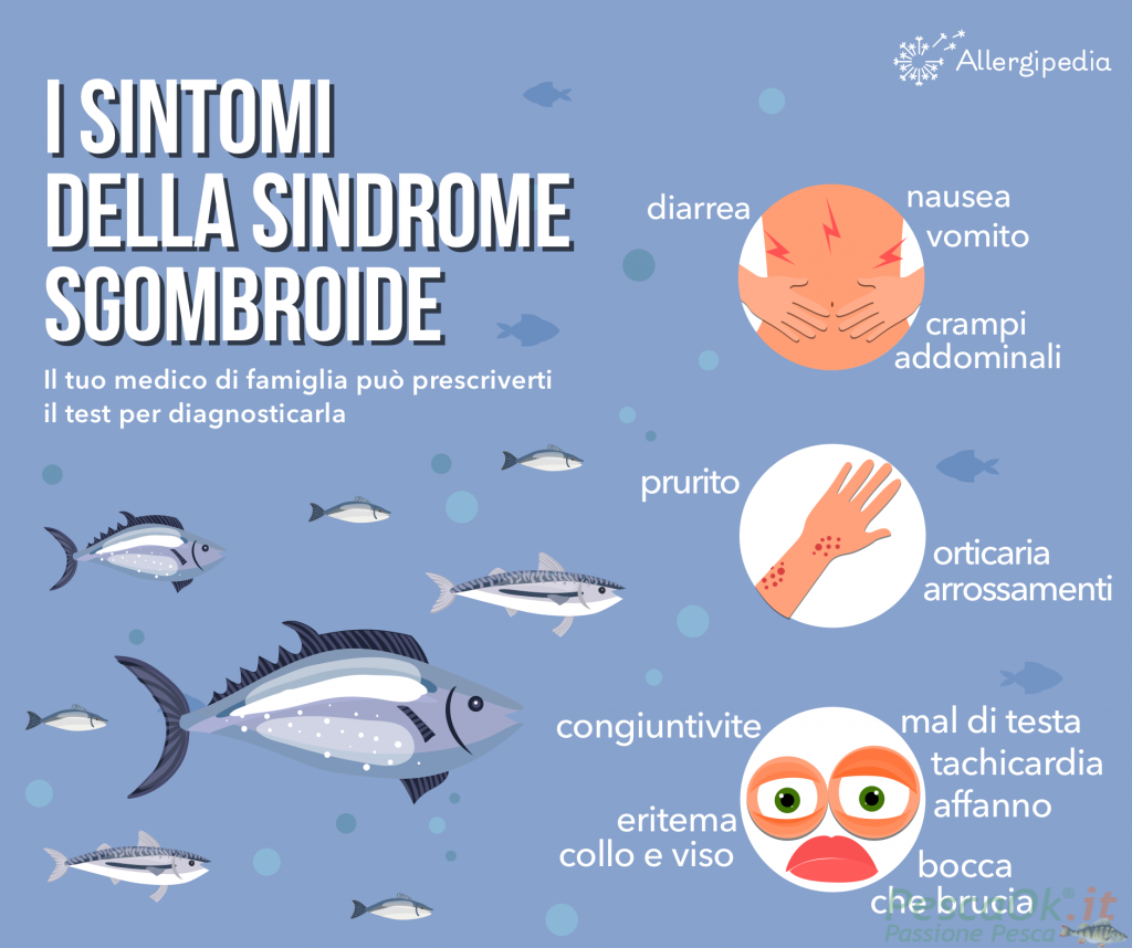Sindrome sgombroide