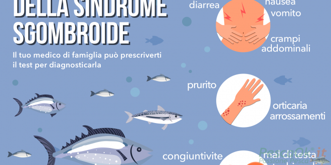 Sindrome sgombroide